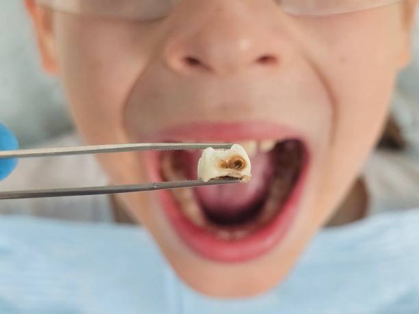 Best Weekend Emergency Dentist in Pocahontas, IA